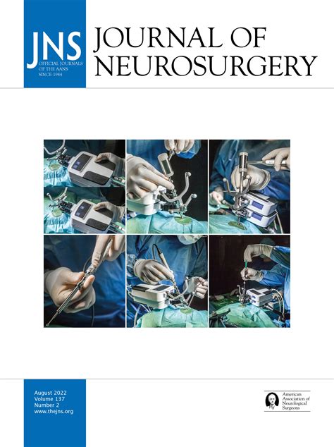 Combined Stereotactic Radiosurgery And Tyrosine Kinase Inhibitor