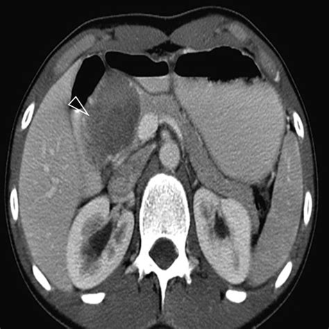 12 Pancreas Radiology Key