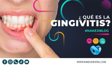 BLOG Qué es la Gingivitis Clínica Dental Nakeji