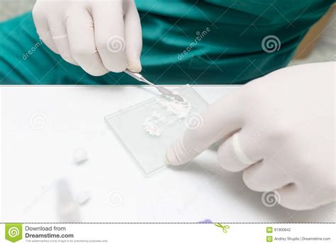 A Dentist Prepares An Implant In The Clinic Stock Photo Image Of