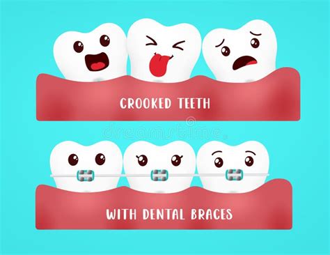 Braces Emoji Stock Illustrations – 72 Braces Emoji Stock Illustrations ...