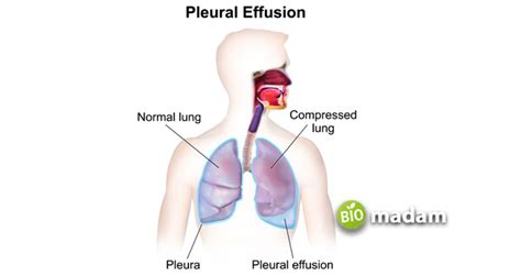 Difference between Diffusion and Effusion - biomadam