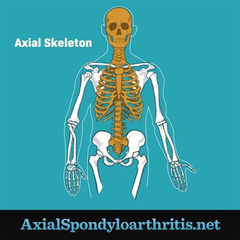 Stages And Progression Of Axial Spondyloarthritis