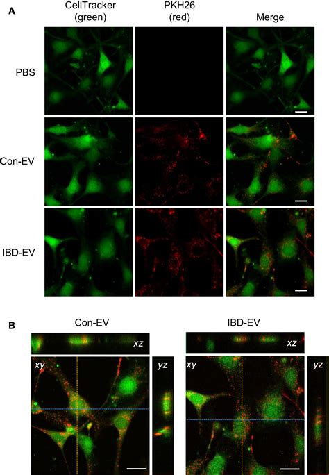 Extracellular Vesicles Derived From Inflamed Murine Colorectal Tissue