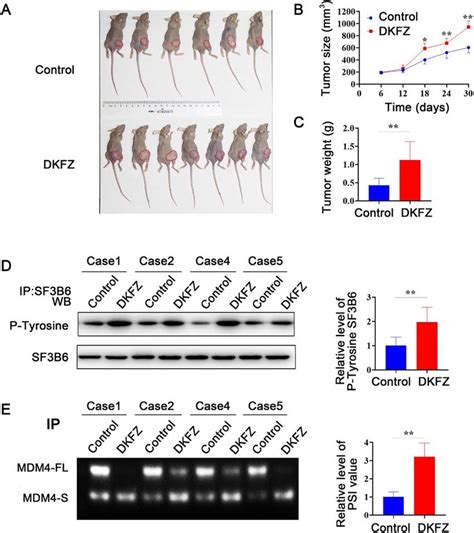 Dkfzp434j0226 Dkfz Inhibits Xenograft Tumor Growth Miapaca 2 Cells