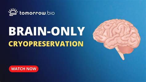 Tomorrow Bio Offering Brain Only Cryopreservation Youtube