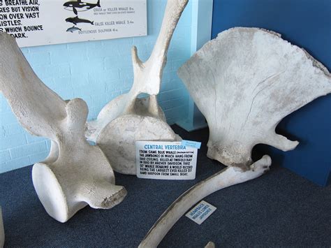 Whale Vertebra The Vertebra And Shoulderblade Of A Whal Flickr