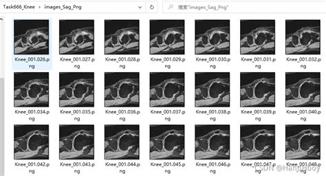 3d医学图像niigz转换为png单次处理单视窗）niigz格式的数据把3d转为2维png图片 Csdn博客