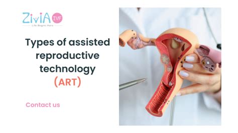 Types Of Assisted Reproductive Technology