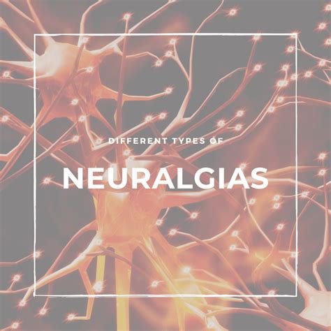 Different Types Of Neuralgias Premier Neurology And Wellness Center