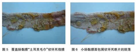 1例肉种鸡坏死性肠炎的诊治 知禽网