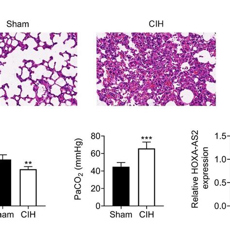 HOXA AS2 Was Downregulated In Lung Tissues From CIH Rat Model A H