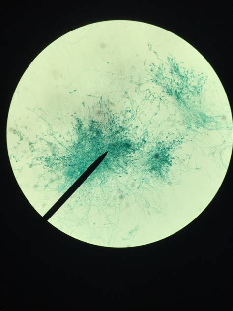 Fungus Identification Flashcards | Memorang