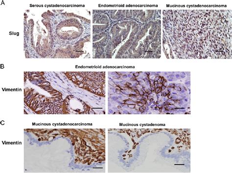 Figure 1 From Immunohistological Insight Into The Correlation Between