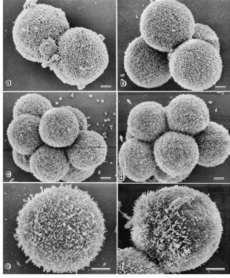 Figure From Development Of Cellular Polarity Of Hamster Embryos