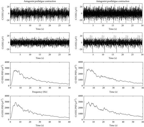 Typical Examples Of Raw Eeg Signals And Power Spectral Density Function Download Scientific