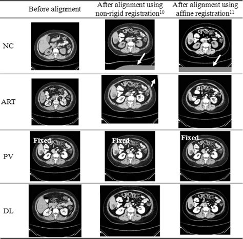 Figure From Content Based Image Retrieval Of Multiphase Ct Images For