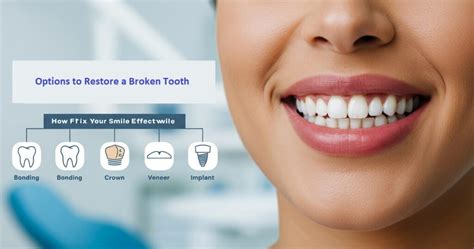 Top Options to Restore a Broken Tooth | Quick & Reliable Solutions