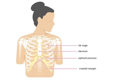 Xiphoid Process Pain Lump Removal And More