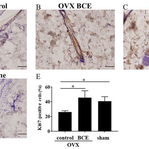 Evaluation Of Cell Proliferation By Expression Of Ki67 Skin From Each Download Scientific