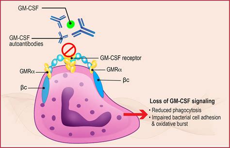 Frontiers The Role Of Gm Csf Autoantibodies In Infection And