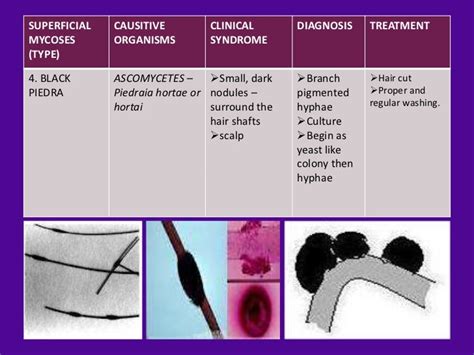 Mycoses