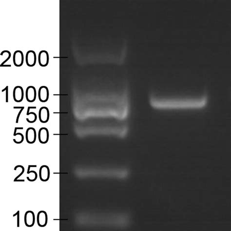 Agarose Gel Electrophoresis Analysis Of Pcr Products Amplified From