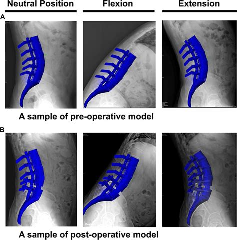 Frontiers Anatomical Parameters Alter The Biomechanical Responses Of