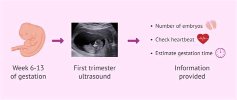 When is the first trimester ultrasound done?