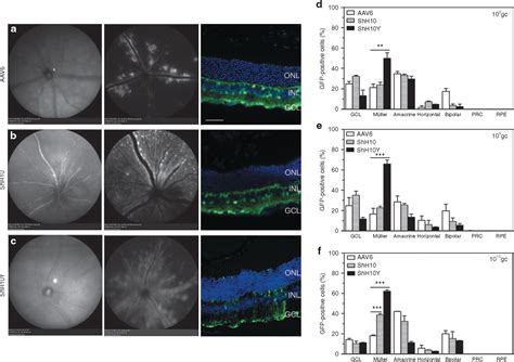 Specific tools for targeting and expression in Müller glial cells