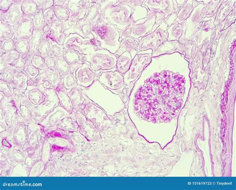 histology  human kidney tissue stock image image  pathology