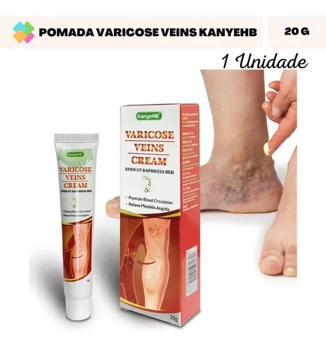 Creme Antivarizes Varizes Vasinhos Manchas Roxas 20 Gramas