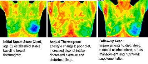 Diagnostic Imaging - East Valley Thermography | East Valley Thermography