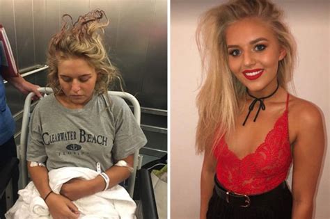 Daily Star On Twitter Freshers Week Student Fractures Skull Jumping