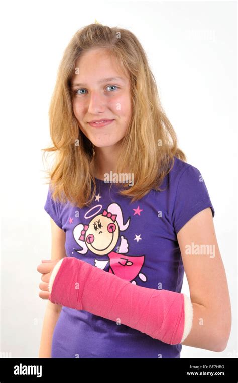 Girl With Cast On A Broken Arm Stock Photo Alamy