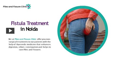 Ppt Best Fistula Treatment In Noida Powerpoint Presentation Free To