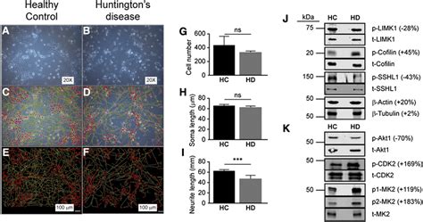 Examination Of Neural Stem Cell Nsc Cultures Representative Download Scientific Diagram