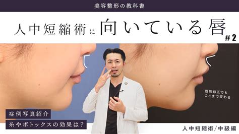 Vol9 あなたの唇タイプは？人中短縮術【中級編】自分の唇のタイプを知ろう症例紹介人中短縮qanda Youtube