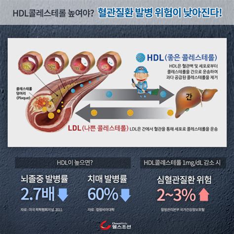 카드뉴스 죽음의 이중주 고혈압and고지혈증 당신의 건강가이드 헬스조선