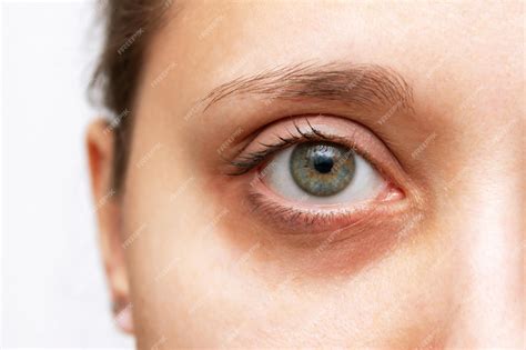 Premium Photo Cropped Shot Of A Young Womans Face With Dark Circle