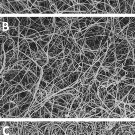 Representative Scanning Electron Microscopy Images Showing Fibrin Clot Download Scientific