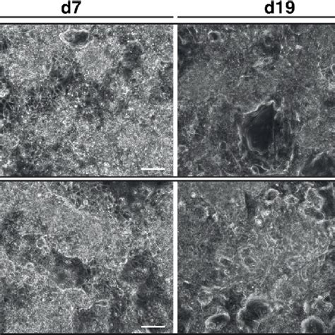 Phase contrast images during the differentiation process. Phase ...