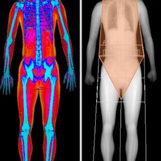 Dual Energy X Ray Absorptiometry Dxa Scan With Lean Mass