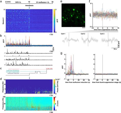 Simultaneous Two Photon Imaging And Wireless Eeg Recording In Mice Heliyon