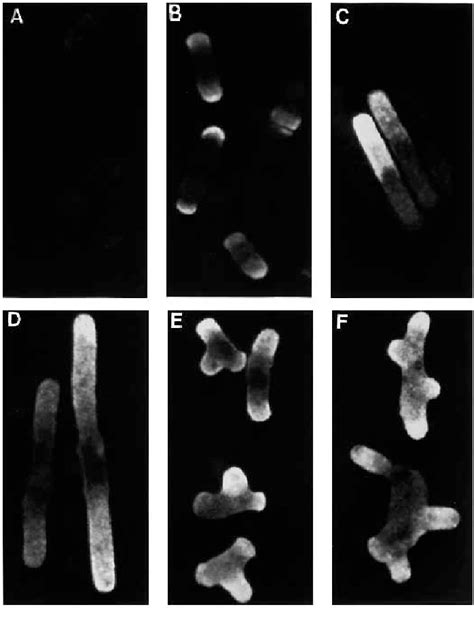 Figure From Localisation Of The Schizosaccharomyces Pombe Rho P