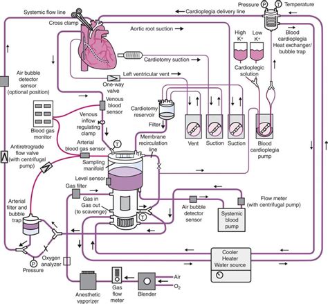 11 Cardiopulmonary Bypass Anesthesia Key