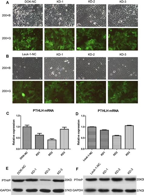 PTHLH And PTHrP Expression In Transfected DOK And Leuk 1 Cells With