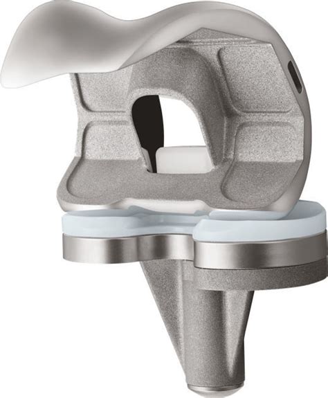 Three Compartment Knee Prosthesis U Us Orthopedics Fixed Bearing