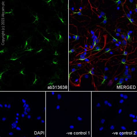 Recombinant Anti Sparcl1 Antibody Epr28135 54 Bsa And Azide Free Ab313639