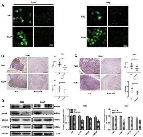 SciELO Brasil Puerarin Inhibits Hepatocellular Carcinoma Invasion